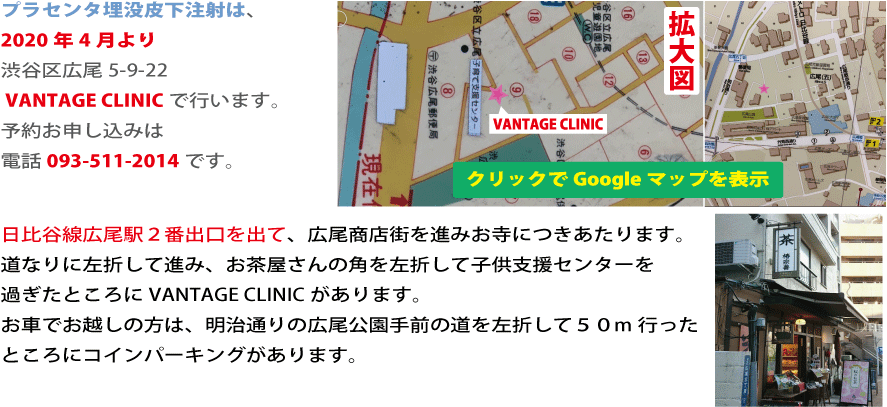 Ђ킫NjbN̍ZxvZ^˂́A2020N4aJL5-9-22  VANTAGE CLINICōs܂B